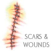 Scars and Wounds